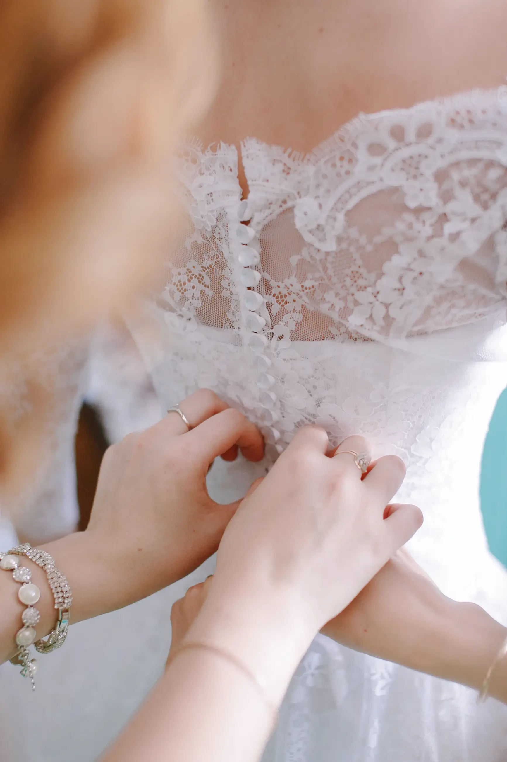 Alterations